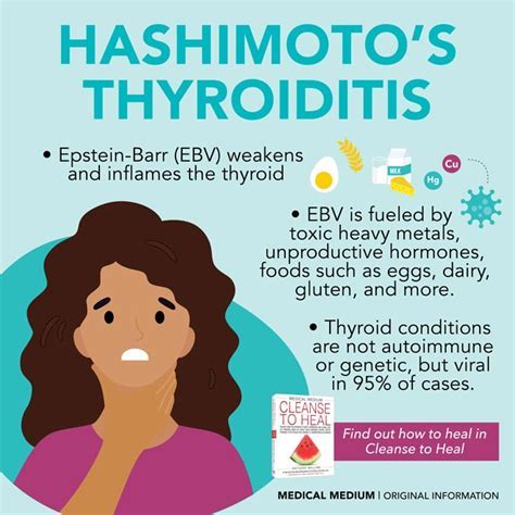 1 Uncover The Ultimate 6 Treatments For Hashimoto Amp 39 S Thyroiditis Now Judicial Data