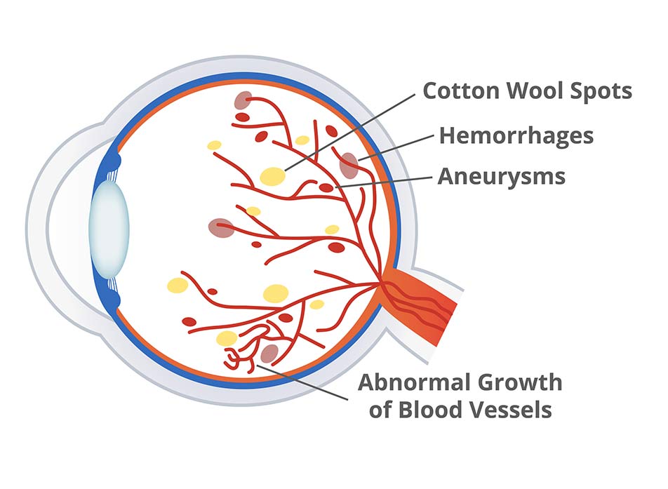 Eye Care Services Ultimate Eye Care Santa Fe Llc