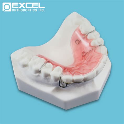 Labial Options Excel Orthodontics