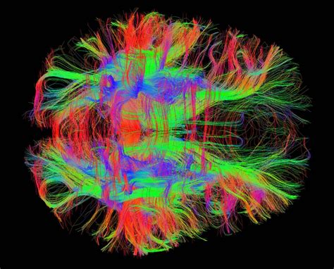 Visualizing The Brain Mit Mcgovern Institute