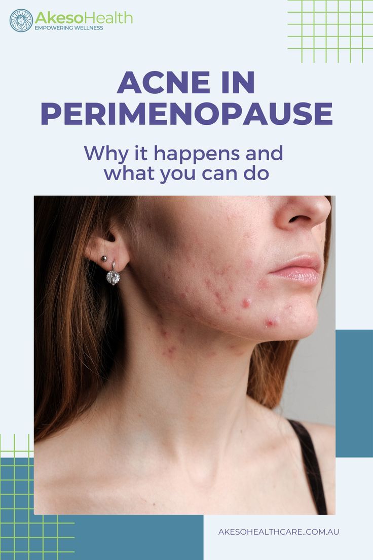 What Is Perimenopause